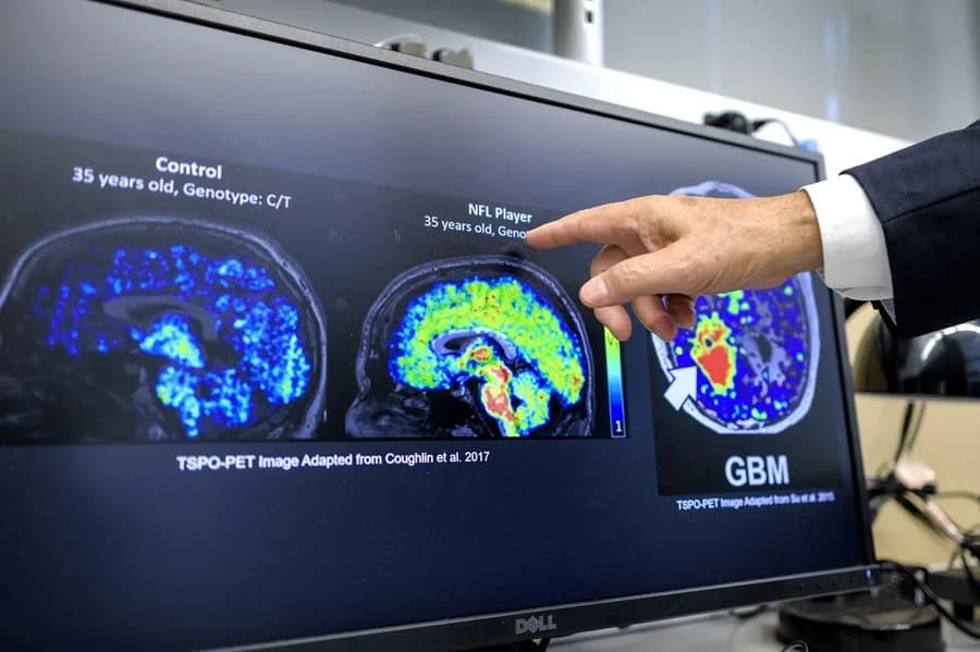 Científicos latinos en EE.UU. podrían cambiar la lucha contra el Alzheimer