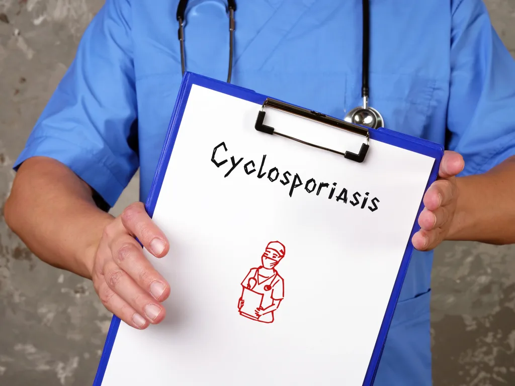 Brote de ciclosporiasis en Florida: Conoce los síntomas y prevención
