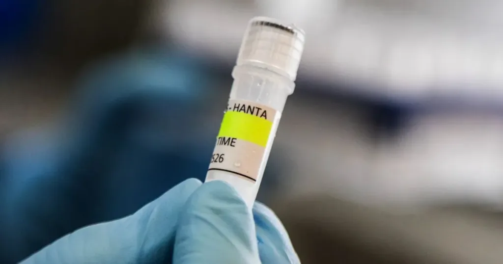 Hantavirus caso confirmado eeuu