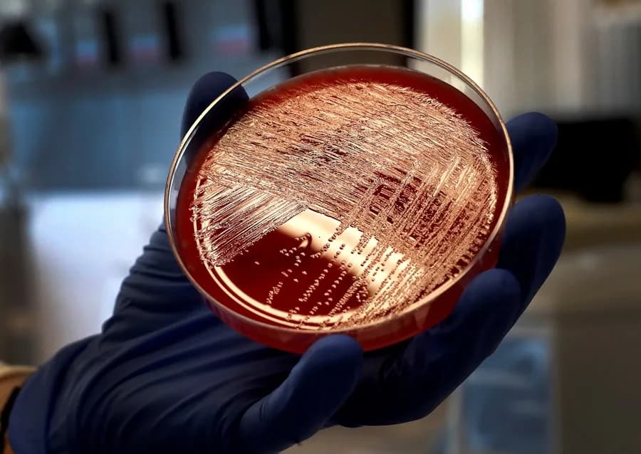 ALERTA: FDA emite alerta máxima por arándanos contaminados con E. coli