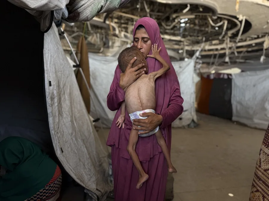 Hambruna extrema golpea a Gaza